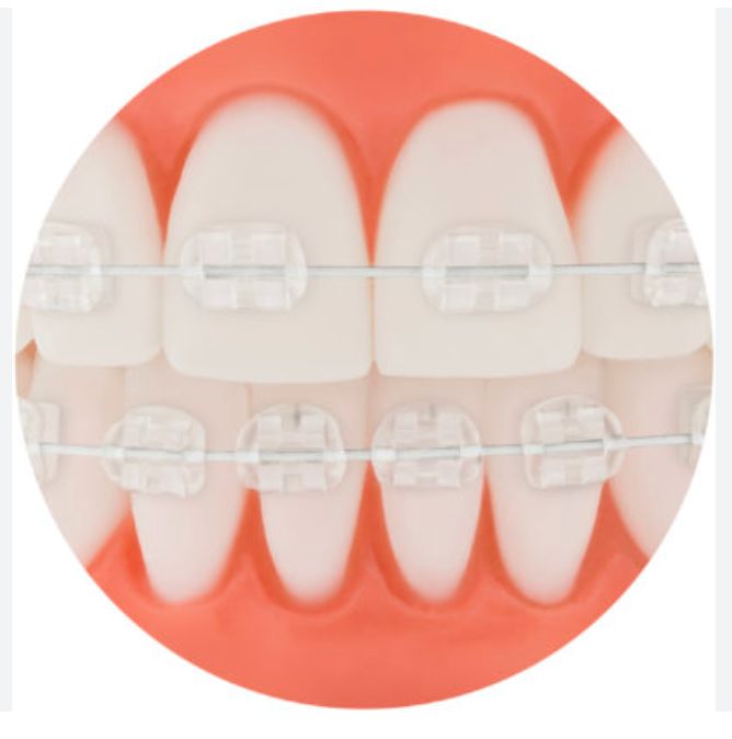 Aesthetic Coated Archwire